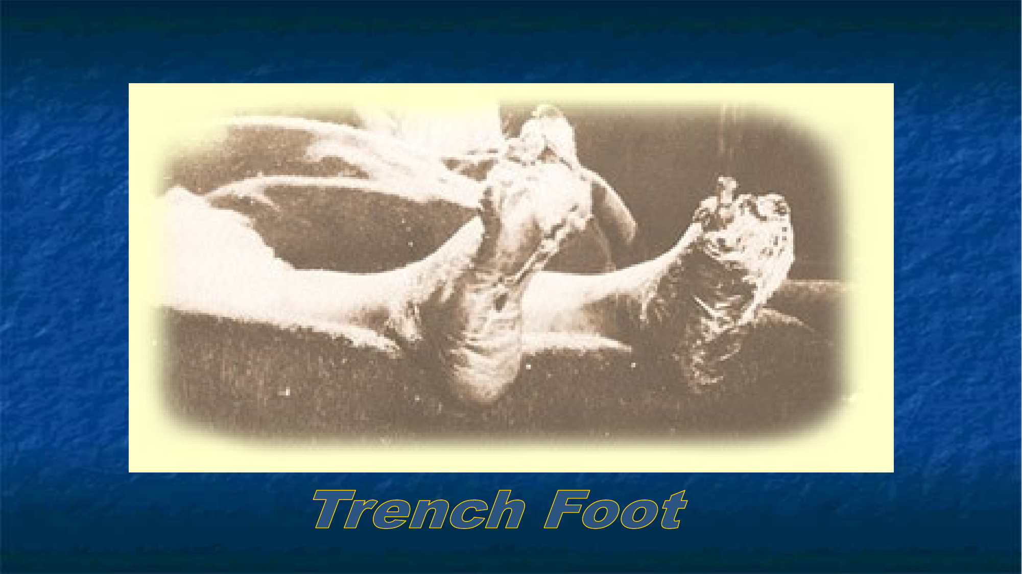 Slide 38