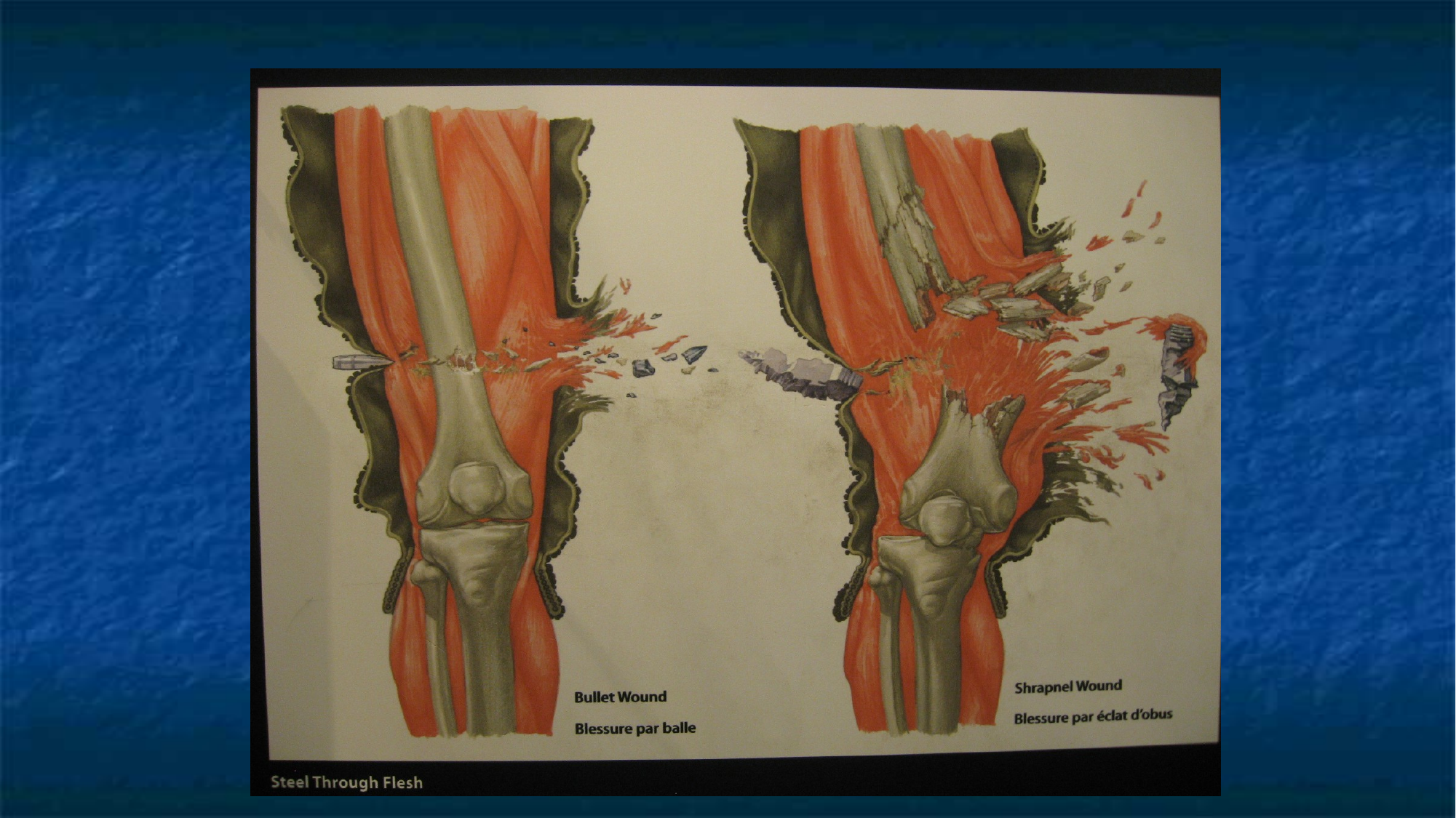 Slide 62